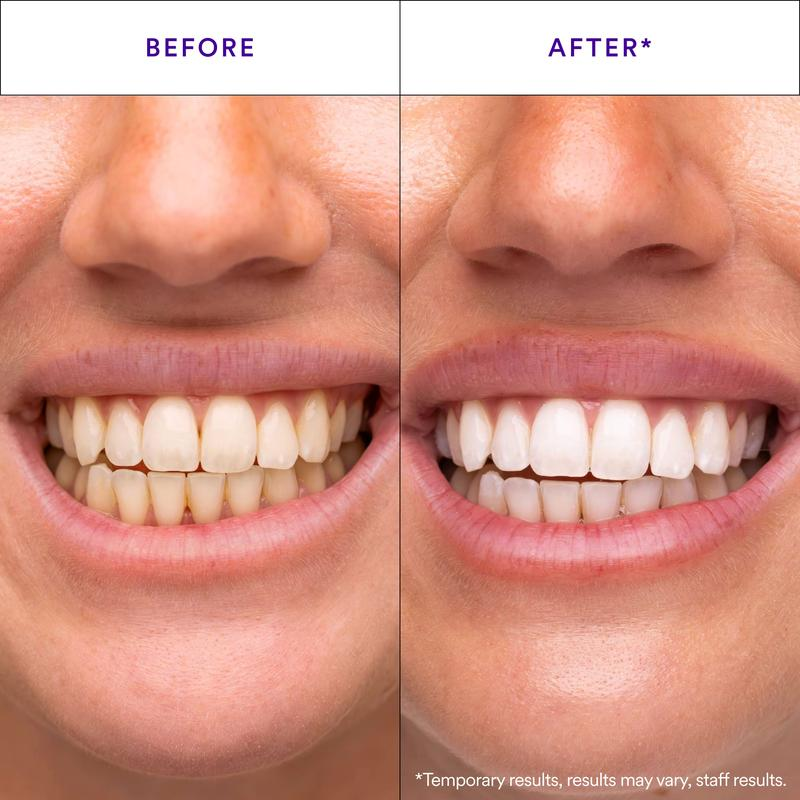 V34 Hismile Teeth Whitening Strips Original Brand Purple Remove Yellow Clean Mouth Dental Care WHITENS AFTER ONE USE Teeth Patch